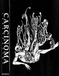 Image 1 of Carcinoma-Labascation MC