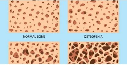 BONE-ACTIV TOPICAL RUB OIL (Bones/Joints). Bone Density-Skeletal System. 