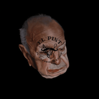 Image 1 of Alzheimer