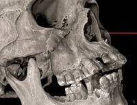 Image 1 of JEFF SRSIC "SKULL STUDY 3" PRINT