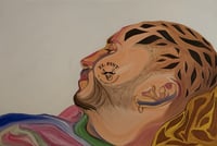 Image 1 of Mi ha fatto i buchi in testa