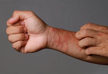 TamaNUskin! Luxurious Moisturizing Exotic Tamanu Nut Seed Body Butter. Eczema. Renews Skin Cells.