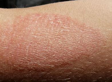 TamaNUskin! Luxurious Moisturizing Exotic Tamanu Nut Seed Body Butter. Eczema. Renews Skin Cells.