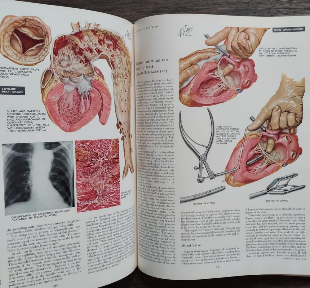 The CIBA Collection of Medical Illustrations: Volume 5 – Heart, By Frank H. Netter