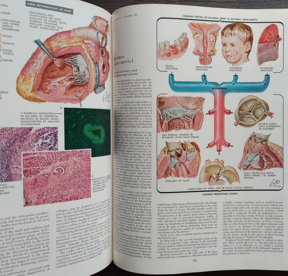 The CIBA Collection of Medical Illustrations: Volume 5 – Heart, By Frank H. Netter