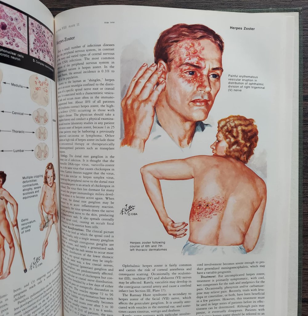 The CIBA Collection of Medical Illustrations: Volume 1 – Nervous System Part 2 – Neurologic...