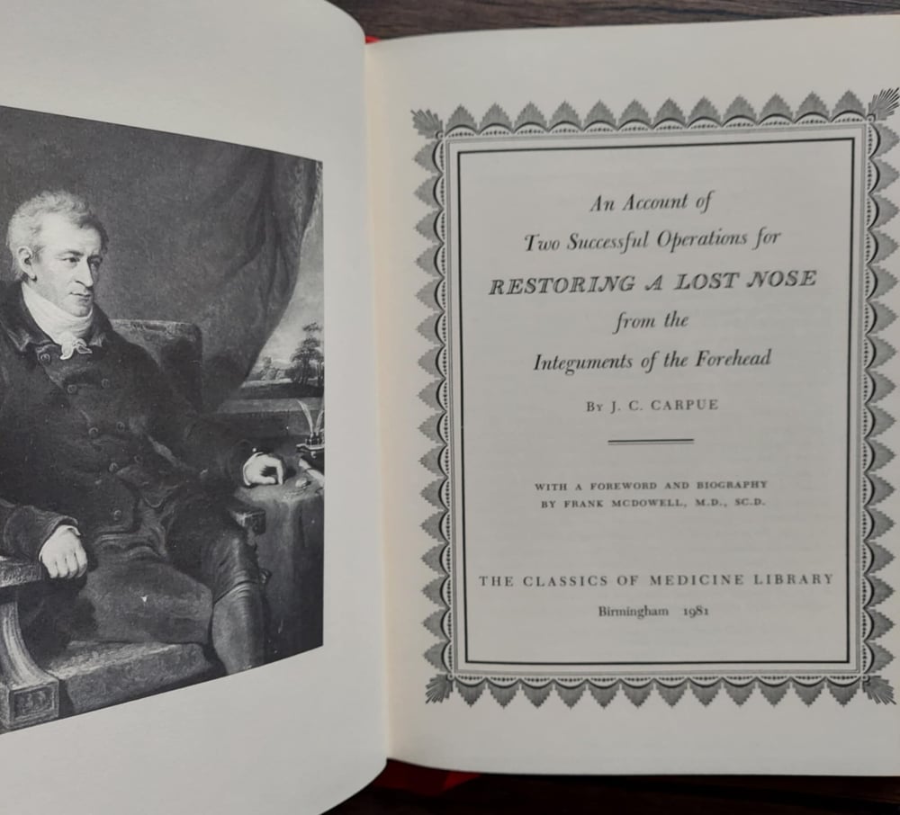 Restoring a Lost Nose, by J. C. Carpue