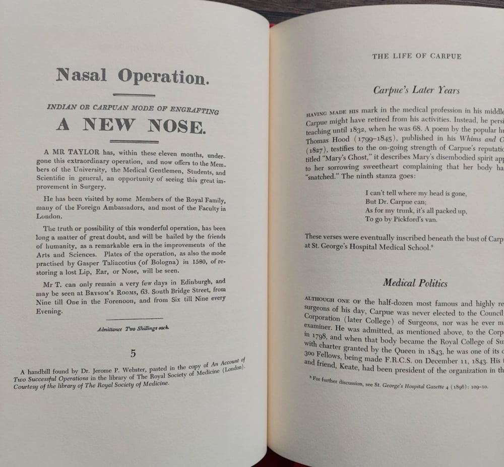 Restoring a Lost Nose, by J. C. Carpue