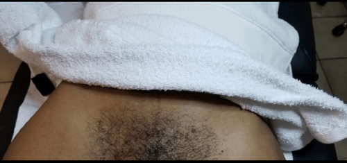 Image of Galentine Brazilian Wax  ( Pair)