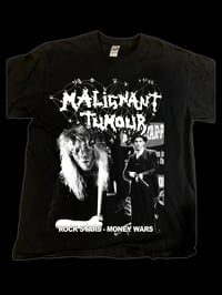 Image 2 of Malignant Tumour 