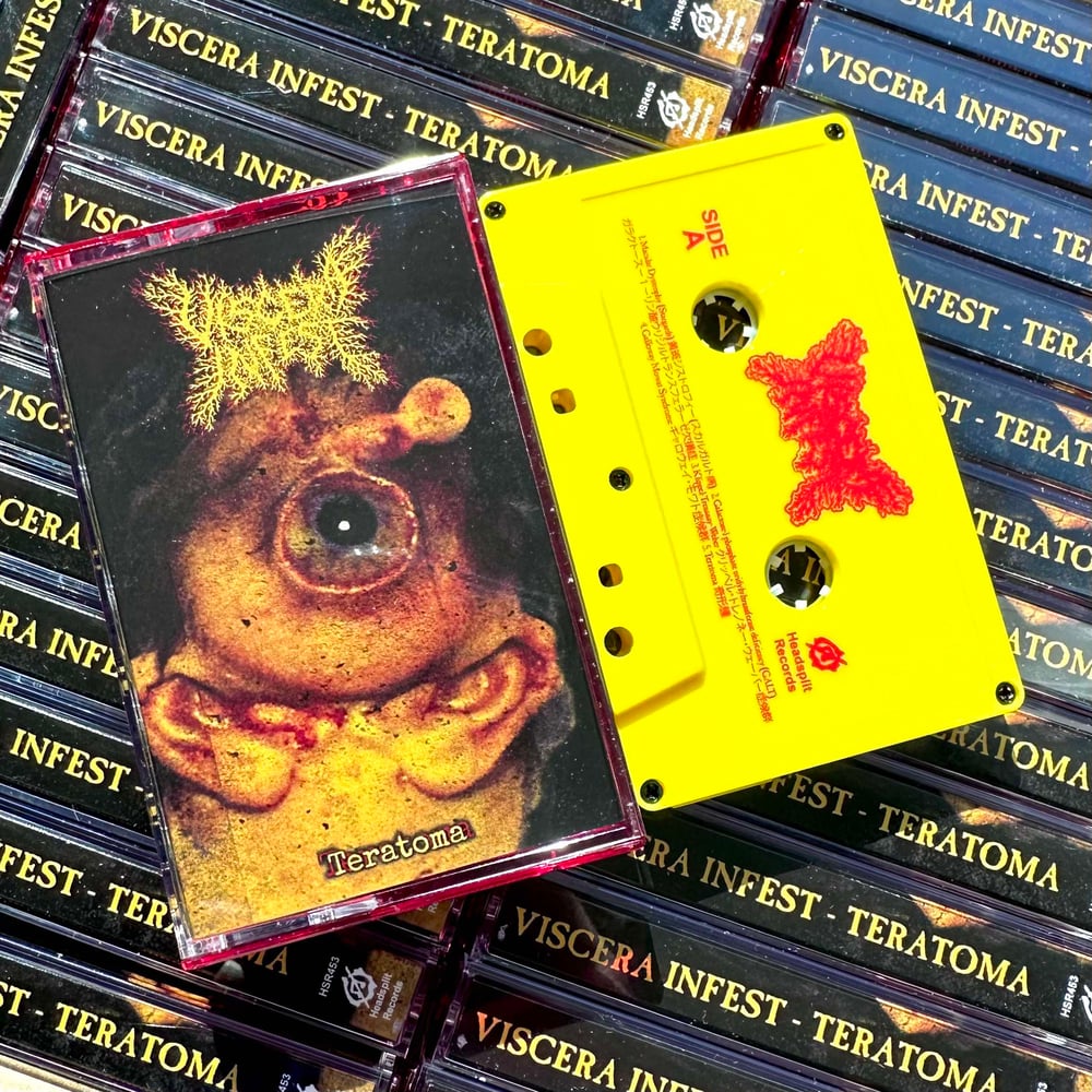 Viscera Infest - "Teratoma" Cassette