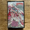 HEMORRHOID - "Raw Materials of Decay" MC
