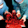 MIASMATIC NECROSIS - Apex Profane" CD 