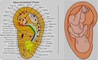 Image 1 of Ear Accupuncture (Auriculo Therapy)