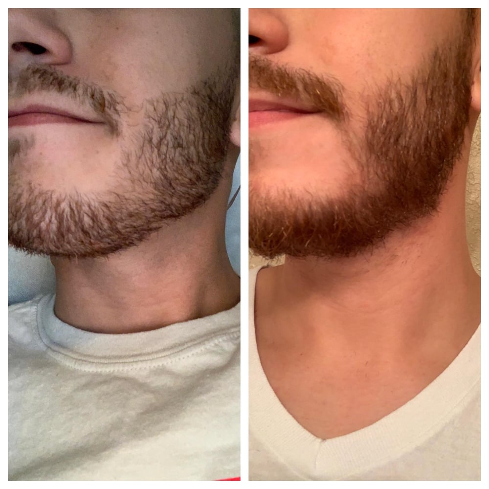 Image of Beard balm