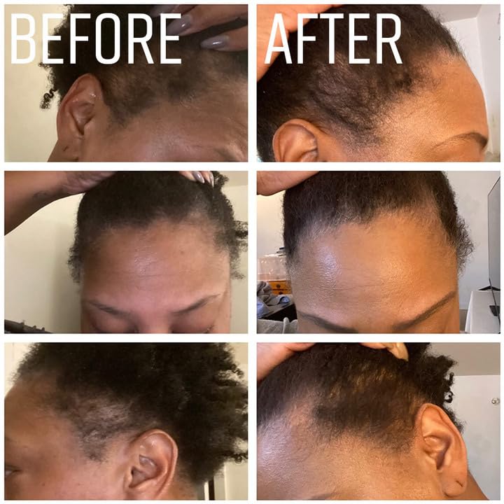 Image of Hair growth oil