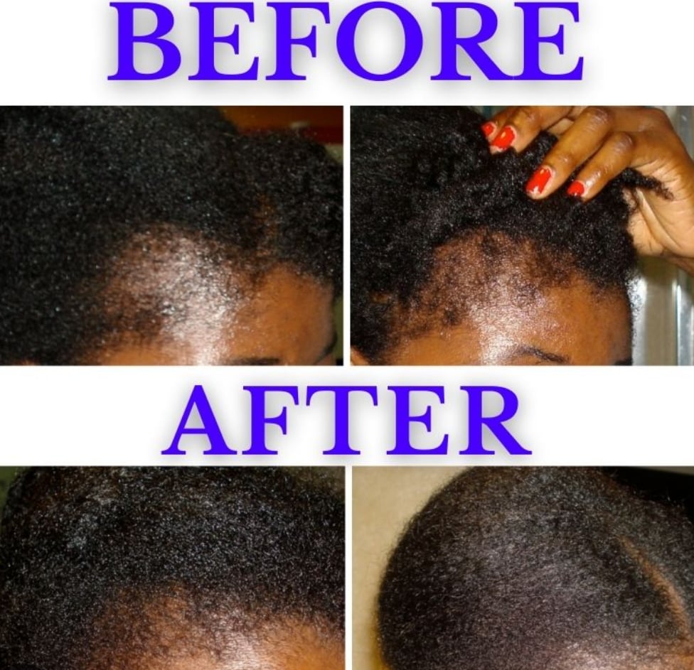 Image of Hair growth oil