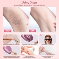 Image 8 of Hair removal device for home use, epilator for whole body