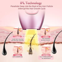 Image 9 of Hair removal device for home use, epilator for whole body