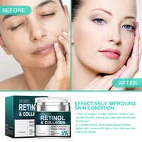 Image 2 of YOUNGCOcloser Retinol Cream to Improve Skin Texture