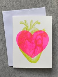 Anatomical Heart Valentine