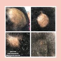 Image 3 of Sweet Herbs Follicle Booster