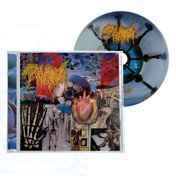 Image of TRICHOMONIASIS "HARVEST OF THE KILLING FIELDS" CD