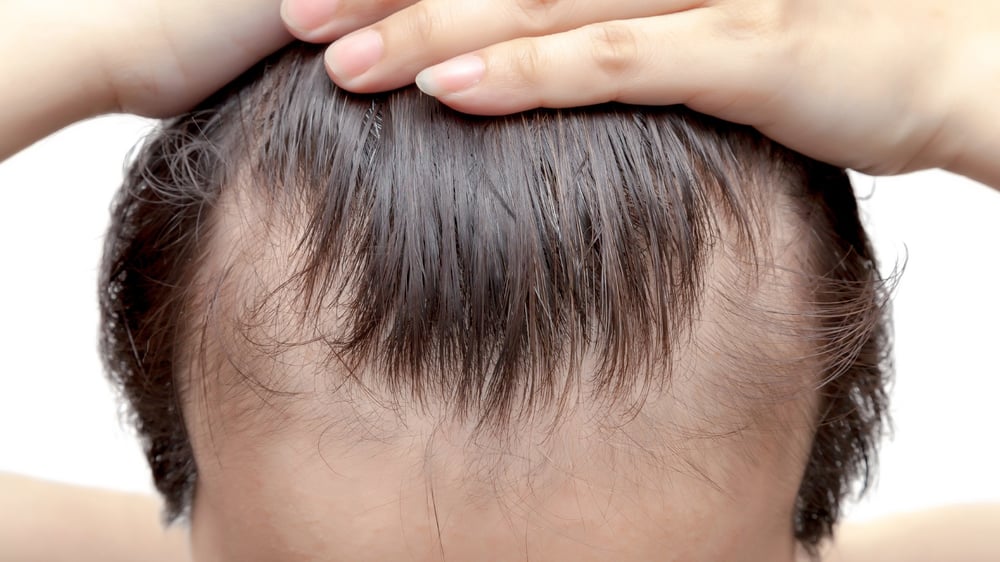 ELECTRIC VEGETATION CELL FOOD-T1 MALE NOURISHER. Impotence. Hair Loss. Hormonal Imbalance.