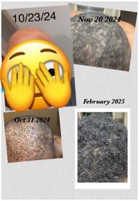 Image 2 of "Growing Glory" HairTEA Treatment(SALE‼️)
