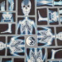 Image 1 of Phantom - Xray
