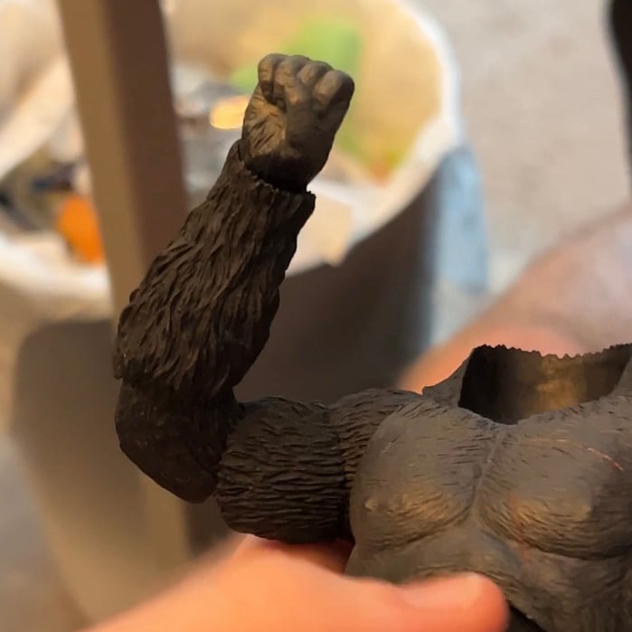 SHMA King Kong 2005 Elbow Joint Replacement