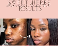 Image 3 of Potent Sweet Herbs Miracle Face Oil