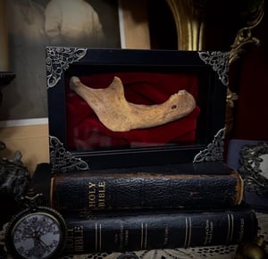 Image of Human Mandible in ShadowBox 