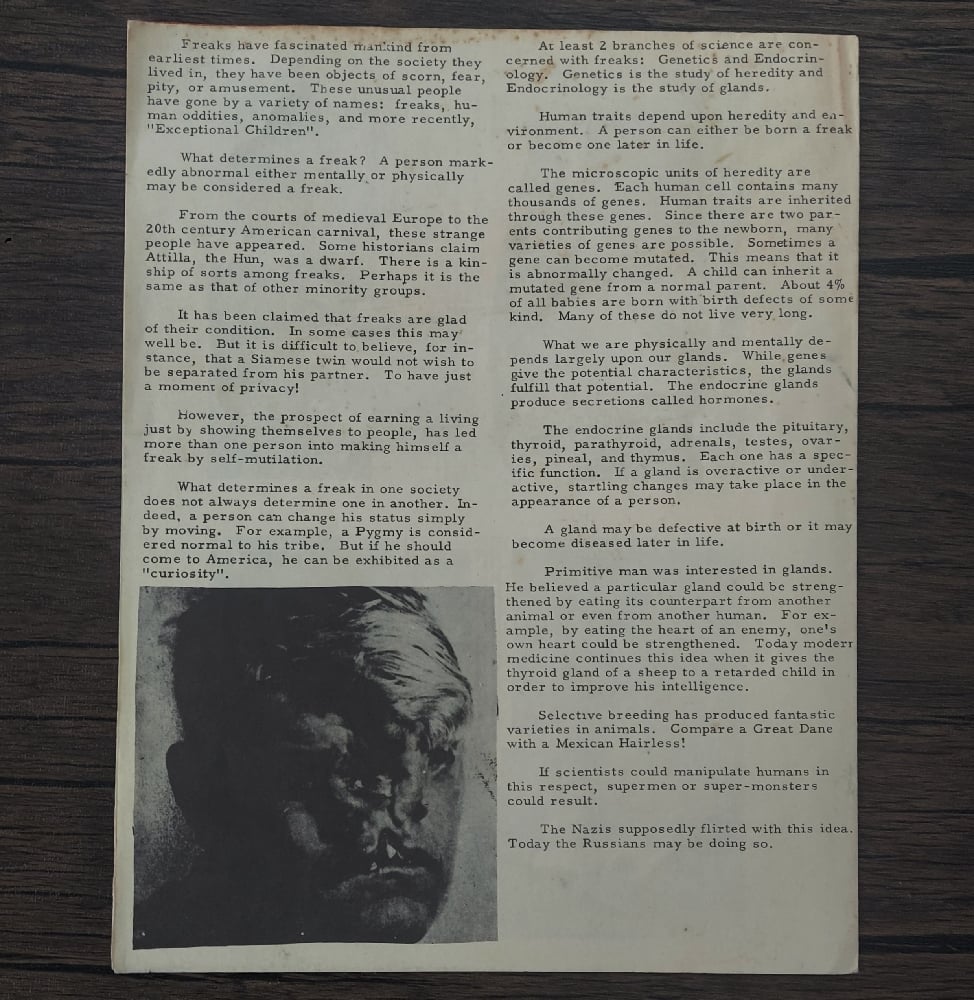 Freaks – A Collector’s Edition of Nature’s Human Oddities