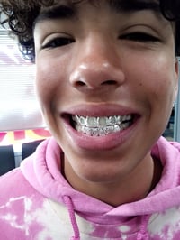 Image 1 of Silver per tooth 