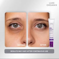 Image 3 of Luxe Organix - Advanced Retinol+Bakuchiol EYE CONTOUR 