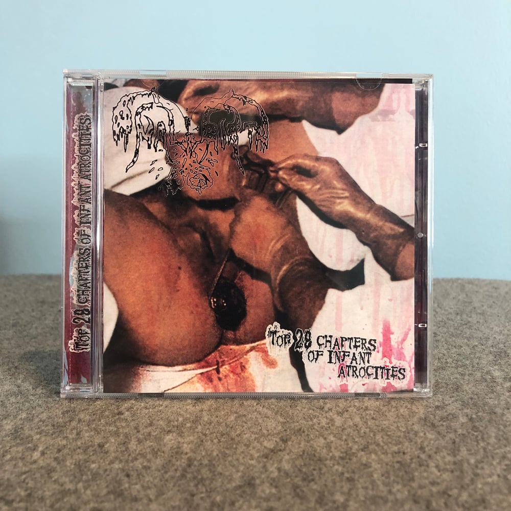 Anal Birth - Top 28 Chapters Of Infant Atrocities CD
