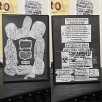 Mallory Weiss Syndrome/Seeping Pus Split 2025 CDr