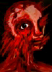a history of trauma III