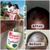 Hair Treatment oil 
