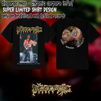 Disgorge (Mex): Chronic Corpora Infest T-Shirt (PRE-ORDER NOW!!!!)