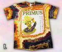 Image 3 of Primus - Rhinoplasty 