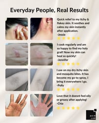 Image 5 of Skin Rescue Plus
