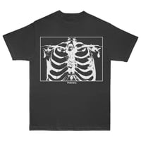 SKELETONIZATION