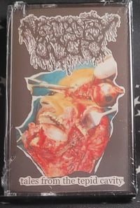 Image 1 of Necropsy Odor - tales from the tepid cavity - MC