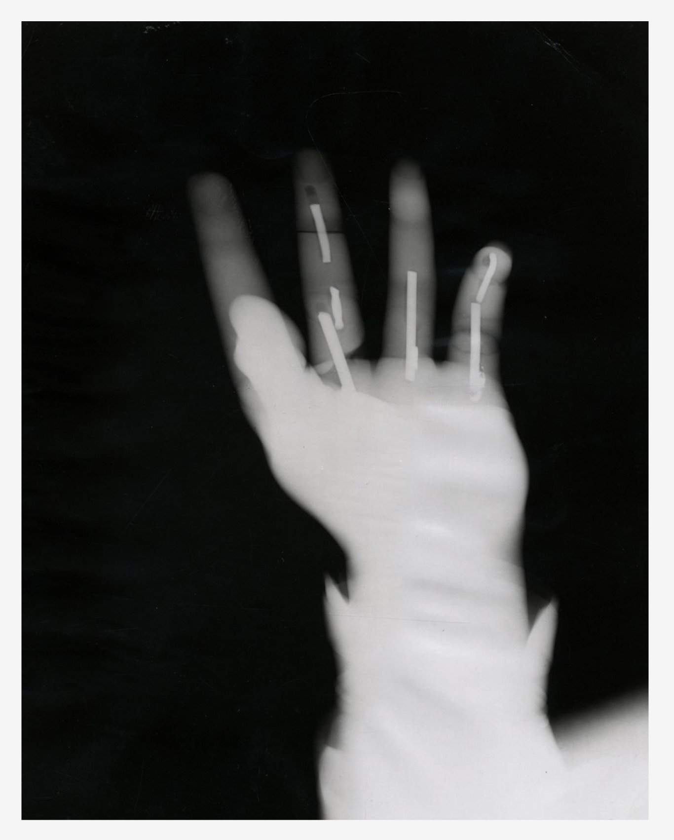 Image of Nuclear Energy Agency: X-ray of the Virgin's left hand, USA ca. 1964