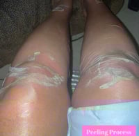 Image 5 of BRIGHTER SKIN PEELING OIL 