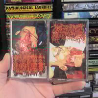 MALIGNANT HYPERTHERMIA/SURGICALLY TRANSMITTED DISEASES "SPLIT" TAPE