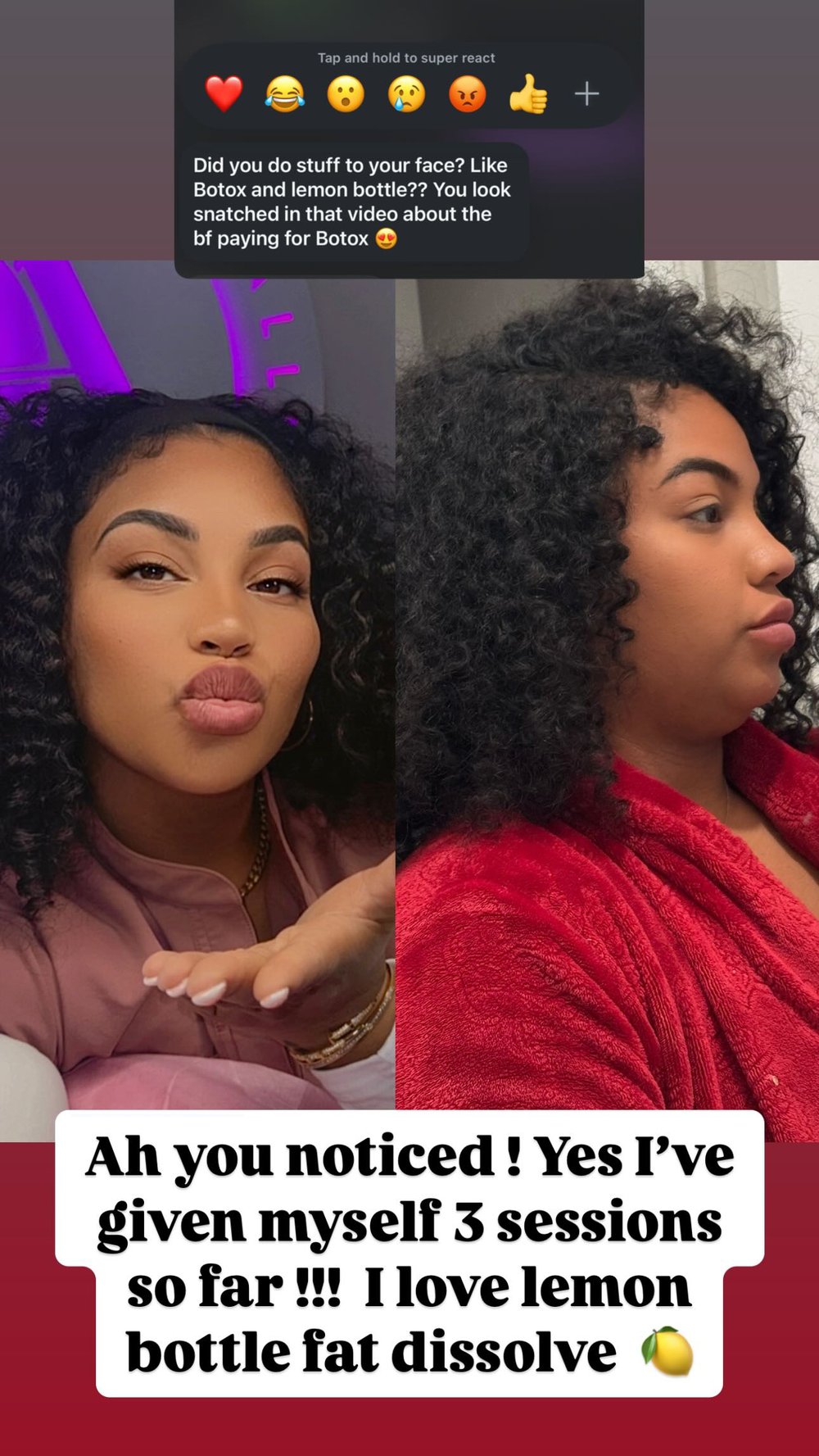 Image of At home Kit 5 10ml Vials 