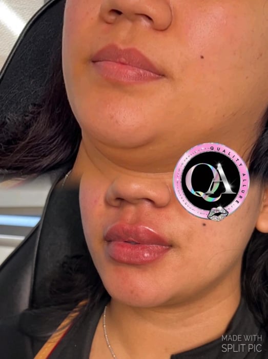 Image of At home Kit 5 10ml Vials 